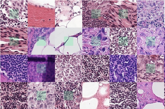 淋巴结切片的组织病理学数据集