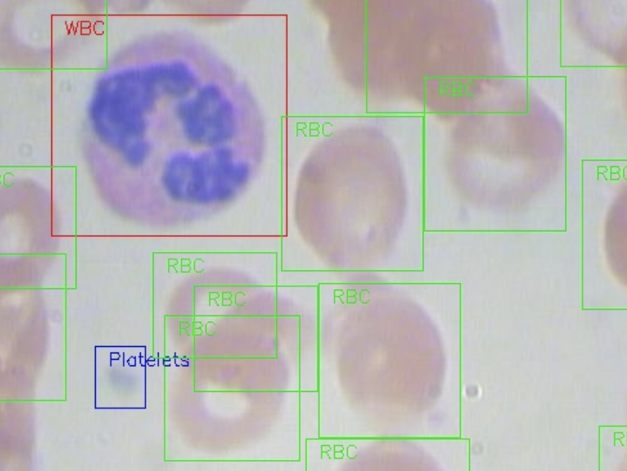 血细胞图像数据集